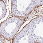 Immunohistochemical staining of human testis shows moderate to strong membranous positivity in endothelial cells.