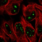 Immunofluorescence staining in U2OS cell line with Anti-MKI67IP monoclonal antibody, showing specific staining of nucleoli in green. Microtubule- and nuclear probes are visualized in red and blue respectively (where available).