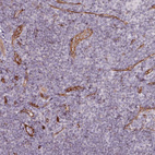 Immunohistochemical staining of human lymphoid tissues shows moderate to strong membranous positivity in endothelial cells.