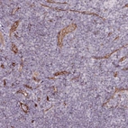 Immunohistochemical staining of human lymphoid tissues shows moderate to strong membranous positivity in endothelial cells.