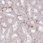 Immunohistochemical staining of human kidney shows moderate membranous positivity in endothelial cells.