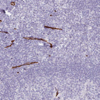Immunohistochemical staining of human tonsil shows moderate to strong membranous positivity in endothelial cells.