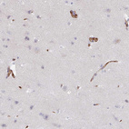 Immunohistochemical staining of human cerebral cortex shows moderate membranous positivity in endothelial cells and very weak cytoplasmic positivity in neurons.