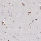 Immunohistochemical staining of human cerebral cortex shows moderate membranous positivity in endothelial cells and very weak cytoplasmic positivity in neurons.
