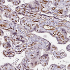 Immunohistochemical staining of human placenta shows moderate to strong membranous positivity in endothelial cells.