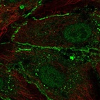 Immunofluorescent staining of human cell line HUVEC TERT2 shows localization to nucleoplasm & cell junctions.