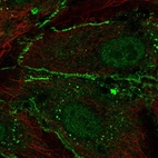 Immunofluorescent staining of human cell line HUVEC TERT2 shows localization to nucleoplasm & cell junctions.