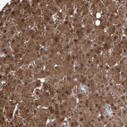 Immunohistochemical staining of human Liver shows strong granular cytoplasmic positivity in hepatocytes.