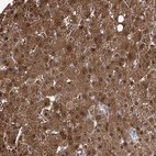 Immunohistochemical staining of human Liver shows strong granular cytoplasmic positivity in hepatocytes.