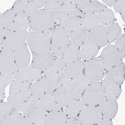 Immunohistochemical staining of human Skeletal muscle shows very weak cytoplasmic positivity in myocytes.