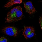 Immunofluorescent staining of human cell line U-251 MG shows localization to vesicles.