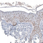 Anti-NIFK Antibody