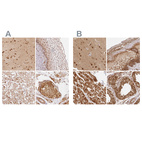 Anti-PSMD1 Antibody