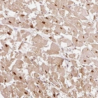 Immunohistochemical staining of human heart muscle shows strong nuclear positivity in cardiomyocytes.