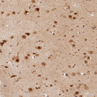 Anti-PSMD1 Antibody