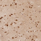 Immunohistochemical staining of human cerebral cortex shows strong nuclear positivity in neurons.