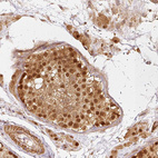 Immunohistochemical staining of human testis shows strong nuclear positivity in cells in seminiferous ducts.