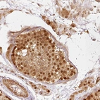 Immunohistochemical staining of human testis shows strong nuclear positivity in cells in seminiferous ducts.