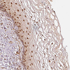 Immunohistochemical staining of human cervix, uterine shows strong nuclear positivity in squamous epithelial cells.