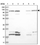 Lane 1: Marker [kDa] 230, 130, 95, 72, 56, 36, 28, 17, 11_br/_Lane 2: Human cell line RT-4_br/_Lane 3: Human cell line U-251 MG_br/_Lane 4: Human plasma_br/_Lane 5: Human Liver tissue_br/_Lane 6: Human Tonsil tissue