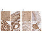 Anti-PSMD1 Antibody