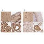 Anti-PSMD1 Antibody
