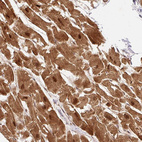 Immunohistochemical staining of human heart muscle shows strong nuclear and cytoplasmic positivity in cardiomyocytes.