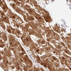Immunohistochemical staining of human heart muscle shows strong nuclear and cytoplasmic positivity in cardiomyocytes.