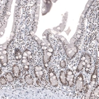 Immunohistochemical staining of human small intestine shows strong positivity in nucleoli in glandular cells.