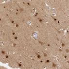 Immunohistochemical staining of human cerebral cortex shows strong nuclear positivity in neurons.