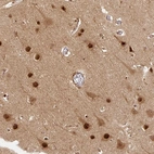 Immunohistochemical staining of human cerebral cortex shows strong nuclear positivity in neurons.