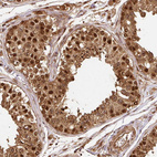 Immunohistochemical staining of human testis shows strong nuclear positivity in cells in seminiferous ducts.