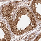 Immunohistochemical staining of human testis shows strong nuclear positivity in cells in seminiferous ducts.