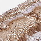 Immunohistochemical staining of human cervix, uterine shows strong nuclear positivity in squamous epithelial cells.