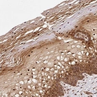 Immunohistochemical staining of human cervix, uterine shows strong nuclear positivity in squamous epithelial cells.