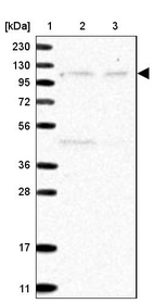 Lane 1: Marker [kDa] 230, 130, 95, 72, 56, 36, 28, 17, 11_br/_Lane 2: Human cell line RT-4_br/_Lane 3: Human cell line U-251 MG