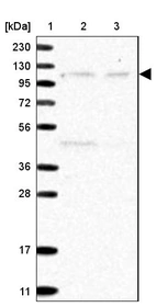 Lane 1: Marker [kDa] 230, 130, 95, 72, 56, 36, 28, 17, 11_br/_Lane 2: Human cell line RT-4_br/_Lane 3: Human cell line U-251 MG