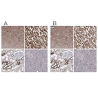 Immunohistochemical staining of human cerebral cortex, heart muscle, kidney and pancreas using Anti-PDHB antibody HPA036744 (A) shows similar protein distribution across tissues to independent antibody HPA036745 (B).