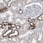 Immunohistochemical staining of human kidney shows strong granular cytoplasmic positivity in cells in distal tubules.