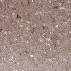 Immunohistochemical staining of human cerebral cortex shows moderate positivity in neuropil.