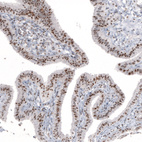 Anti-NIFK Antibody