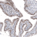 Immunohistochemical staining of human fallopian tube shows strong positivity in nucleoli in glandular cells.
