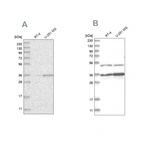 Western blot analysis using Anti-PDHB antibody HPA036744 (A) shows similar pattern to independent antibody HPA036745 (B).