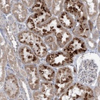 Anti-SCN11A Antibody
