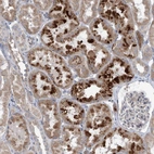 Anti-SCN11A Antibody