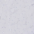 Immunohistochemical staining of human skeletal muscle shows low expression as expected.