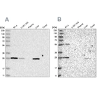 Western blot analysis using Anti-BPHL antibody HPA036752 (A) shows similar pattern to independent antibody HPA036753 (B).