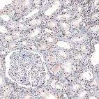 Immunohistochemical staining of human kidney shows strong positivity in nucleoli in cells in tubules.