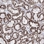 Immunohistochemical staining of human kidney shows high expression.