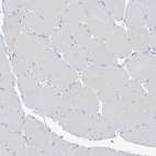 Immunohistochemical staining of human skeletal muscle shows low expression as expected.
